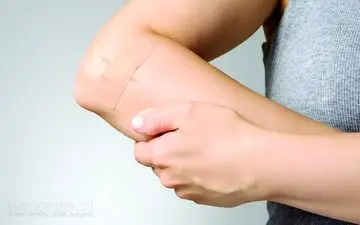 دلیل دیر خوب شدن زخم ها چیست؟

