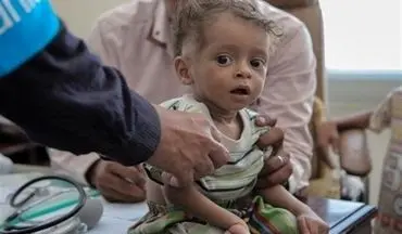  جدیدترین آمار از فوتی‌ها و مبتلایان به وبا در یمن 