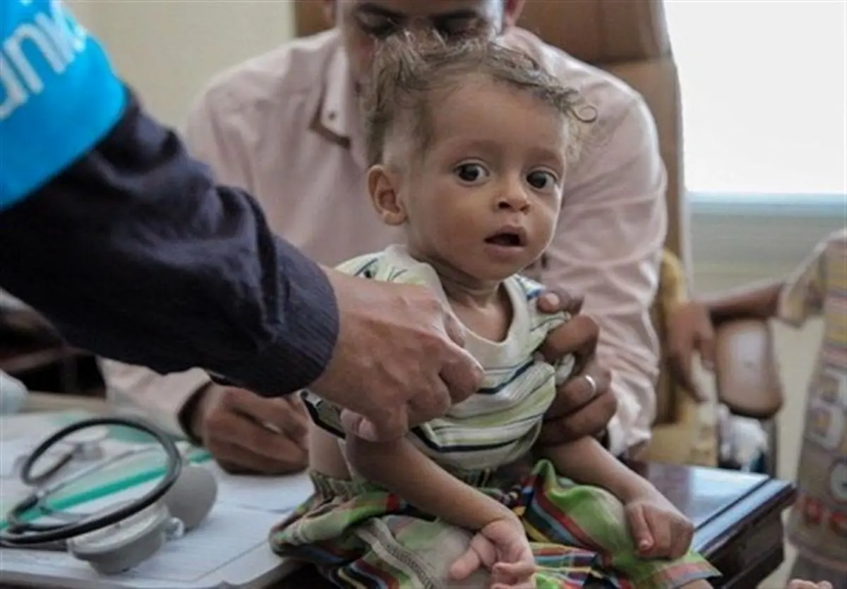  جدیدترین آمار از فوتی‌ها و مبتلایان به وبا در یمن 