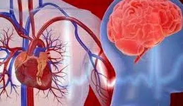 اصلی ترین عامل سکته‌های قلبی و مغزی چیست؟ 