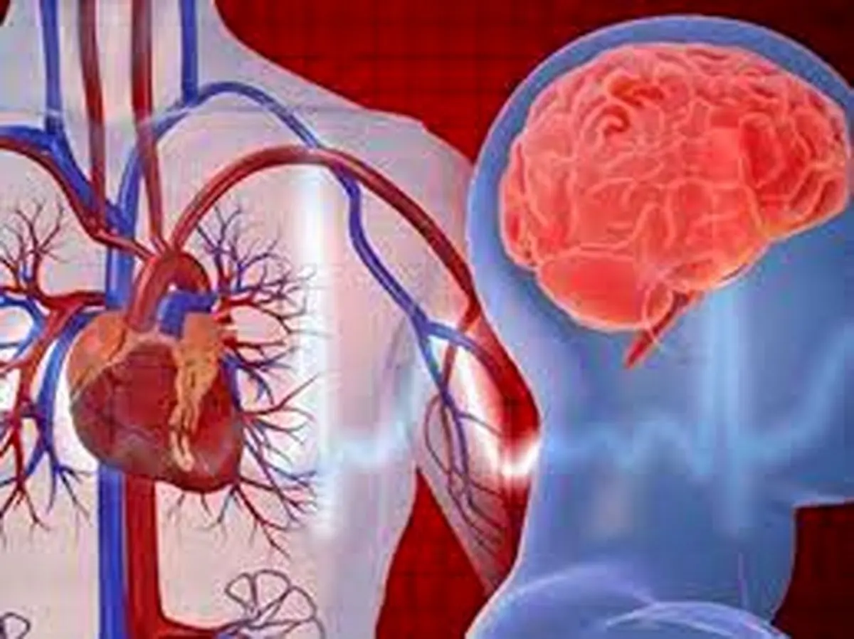 اصلی ترین عامل سکته‌های قلبی و مغزی چیست؟ 