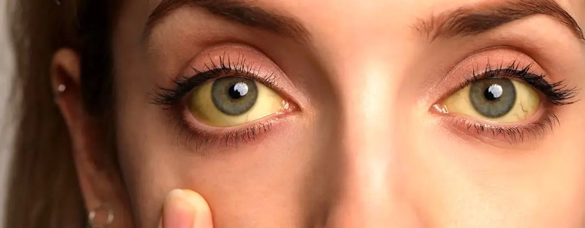 برای سلامت چشم هایتان این ویتامین‌ها را مصرف کنید