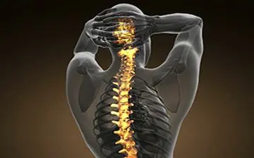 ۸۰ درصد مردم کمردرد را تجربه می کنند