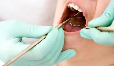 منظور از دندان نهفته چیست
