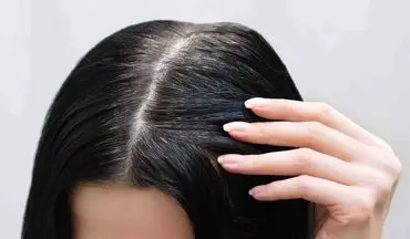 نکاتی برای جلوگیری از ریزش مو از منظر طب سنتی