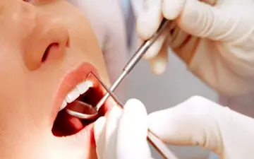 آیا جرم گیری دندان ضرر دارد؟