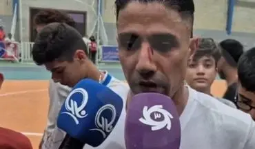 بازگشت درخشان فوق ستاره به میادین با صورت زخمی