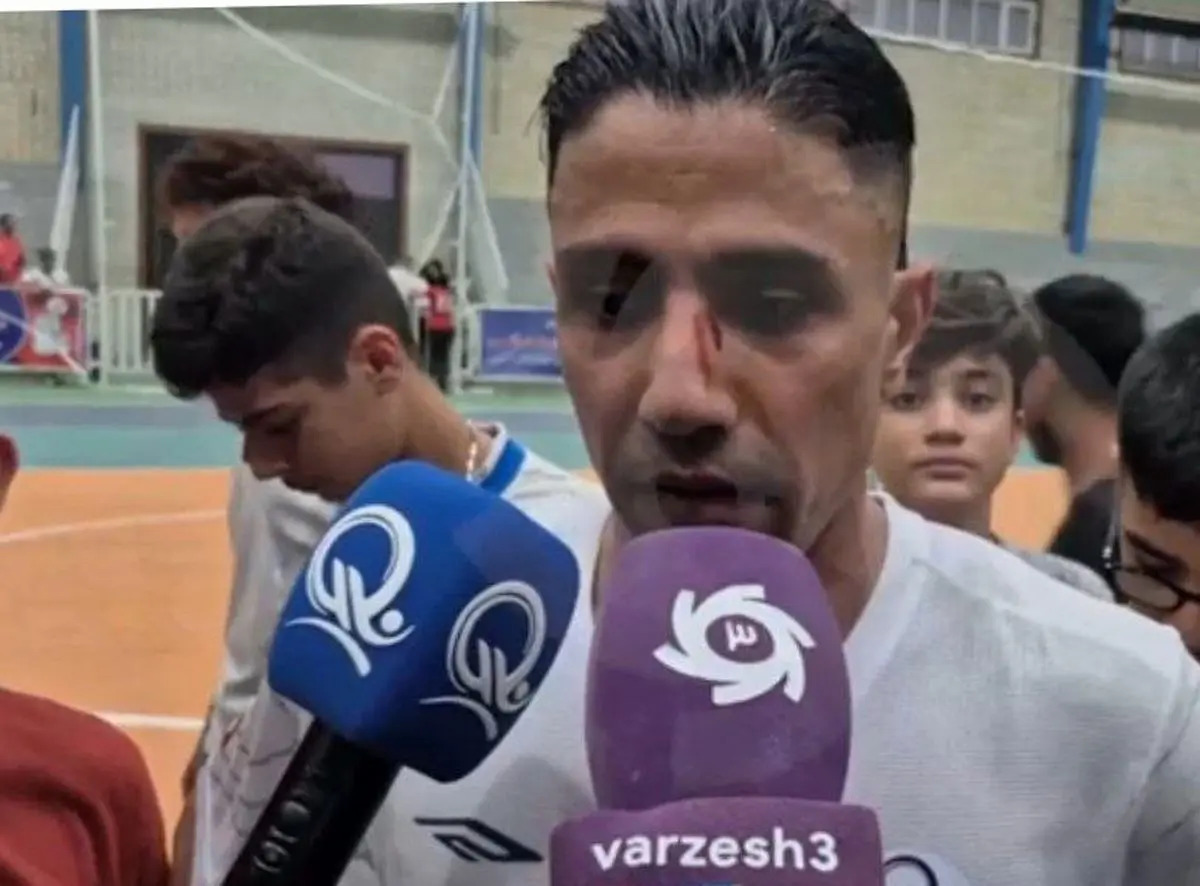 بازگشت درخشان فوق ستاره به میادین با صورت زخمی