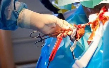 شرایط ذخیره‌ خون بندناف در سازمان انتقال خون

