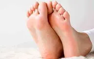 شکل و رفتار پاهای شما چه بیماریهای از درون شما را آشکار می‌سازد؟
