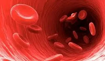 چطور کم خونی را درمان کنیم