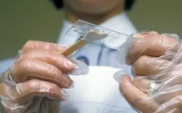 پاپ اسمیر، سپر دفاعی بانوان در برابر این بیماری کشنده