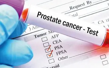 علایم اولیه سرطان پروستات 

