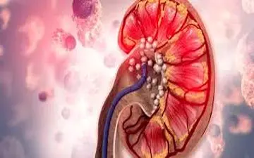 این هورمون سلامت کلیه شما را بشدت به خطر می اندازد!