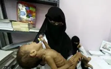 وداع جانسوز مادر یمنی با جسد اعضای خانواده‌اش