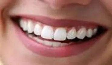 اصلی ترین علت تغییر رنگ دندان و بهترین راه پیشگیری