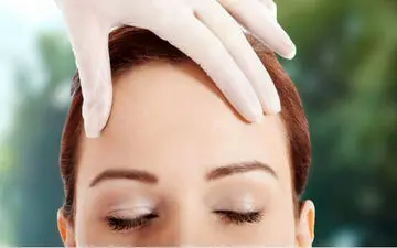 پیشانی ناندرتال چیست؟+ علت و روش درمان 