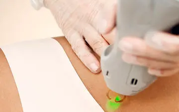 مراقبت های لازم بعد از لیزر بیکینی: نکات مهم و ممنوعیت ها
