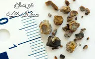 چطور از ایجاد سنگ کلیه پیشگیری کنیم؟