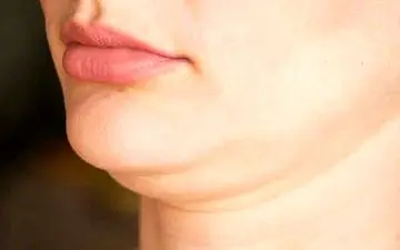 کوچک کردن غبغب با چند حرکت در خانه