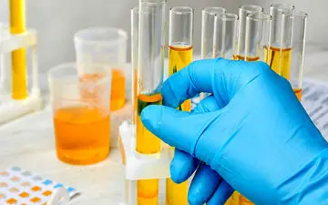 علت رنگ زرد ادرار چیست؟