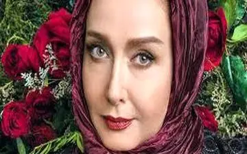 عکسی دیده نشده از خانم بازیگر قبل و بعد از عمل زیبایی