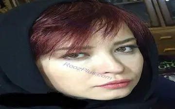 تغییر چهره بازیگر زن مشهور+ عکس