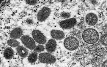 مدت زمان نهفتگی آبله میمون چقدر است؟