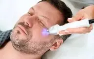 پوستت شل شده؟ این روش بدون جراحی، معجزه می‌کنه!