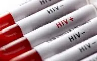 آزمایش ایدز رایگان و محرمانه انجام می‌شود/ازدواج و اشتغال 2 چالش اجتماعی مبتلایان HIV