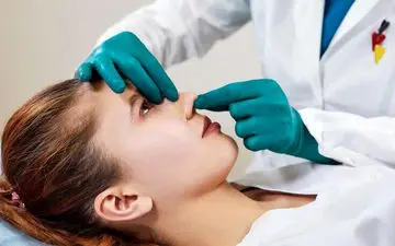 علت پریود شدن بعد از عمل بینی چیست؟