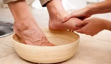 داغی و سوزش کف پا نشانه چیست؟