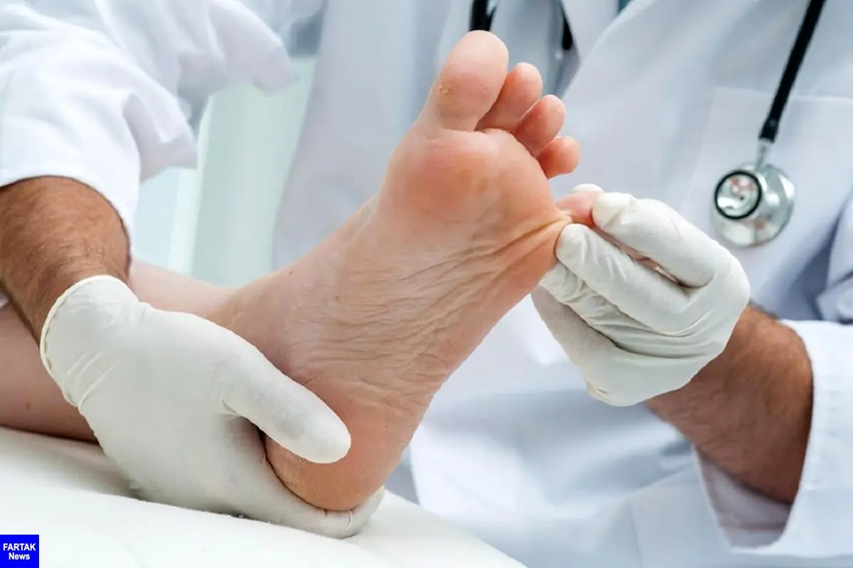  عفونت ناخن فرو رفته در گوشت انگشت پا را چگونه درمان کنیم؟