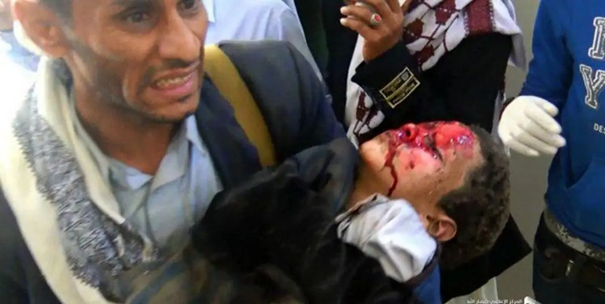 ائتلاف سعوی به کشتار کودکان یمنی در صعده اذعان کرد