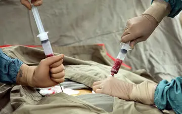 اولین بار دربخش پیوند مغز استخوان بیمارستان امام رضا (ع) انجام شد