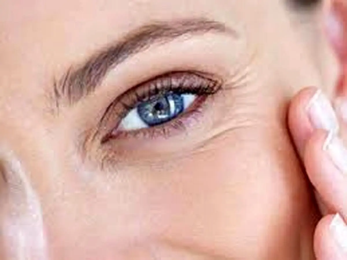 درمان خانگی چروک دور چشم| دیگه پول به داروهای گران نده!