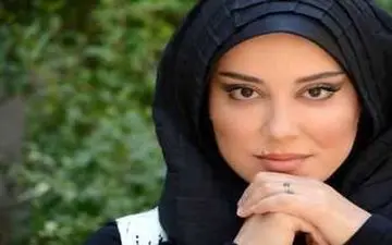 آشا محرابی بعد از عمل زیبایی| آشا محرابی چه بود و چه شد!