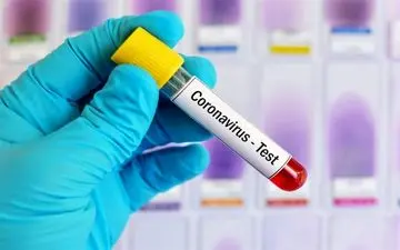 آخرین آمار کرونا در کشور| فوت ۲۰۹ نفر در ۲۴ ساعت گذشته
