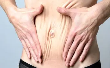 لاغر شدید اما پوست‌تان شل شده؟ نگران نباشید! این راهکارها پوستتان را سفت و جوان کنید