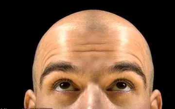 دستور ساخت یک ترکیب گیاهی ساده برای جلوگیری از "ریزش مو"