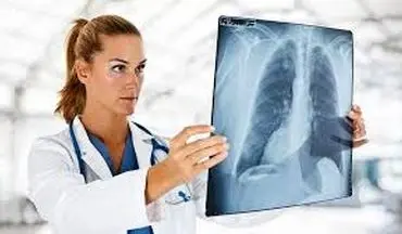 علائم اولیه سرطان ریه را بشناسید