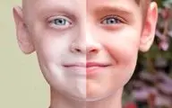علائم سرطان خون در کودکان را بشناسید