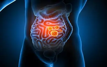 تأثیر داروهای مصرفی بر سلامتی روده و مغز: پژوهشی جدید درباره اثرات طولانی‌مدت داروها