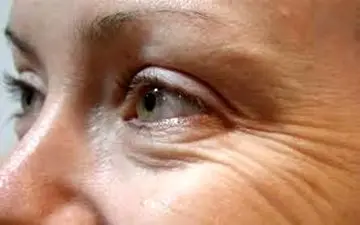 عوامل ایجاد  چین و چروک صورت