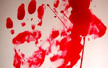 اعتراف به قتل دختر جوان به خاطر حمایت از سگ زخمی