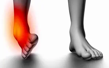 جلوگیری از پیچ خوردگی مچ پا