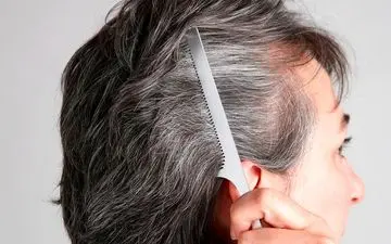 ۳ عامل سفید شدن مو