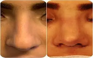 این جراحی برای آرامش روان شما بسیار عالی است؟