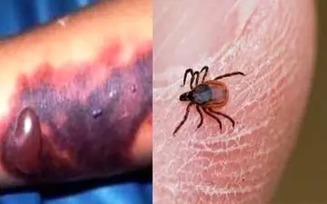 خطر ابتلا به تب کنگو در ذبح غیربهداشتی دام/ گوشت قرمز را از مراکز مجاز بخرید