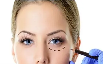 مراقب عمل‌های زیبایی چشم باشید